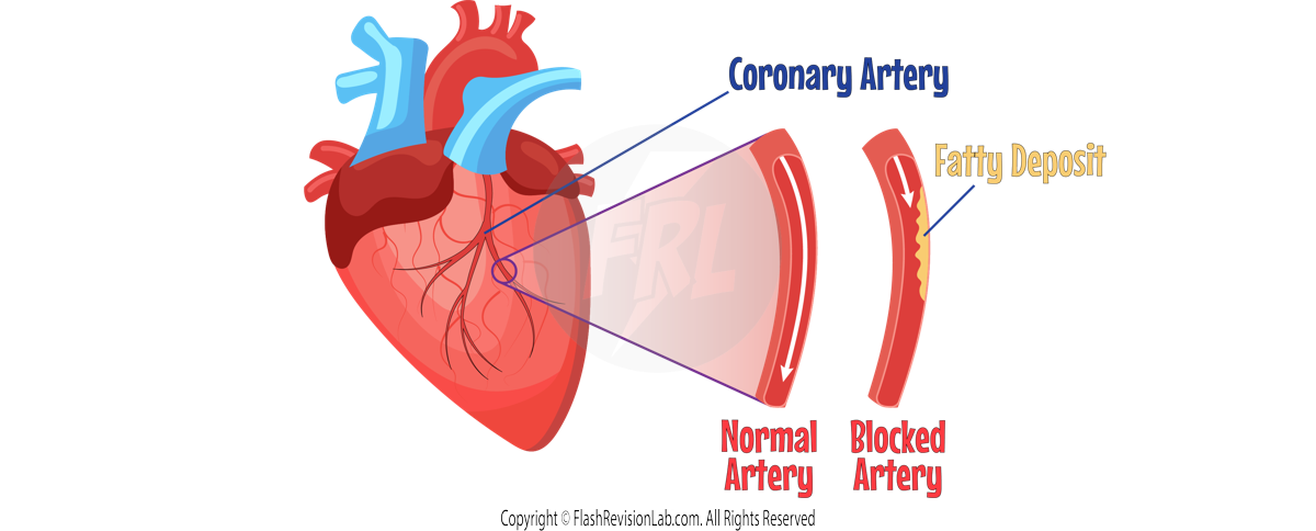 Coronary Artery